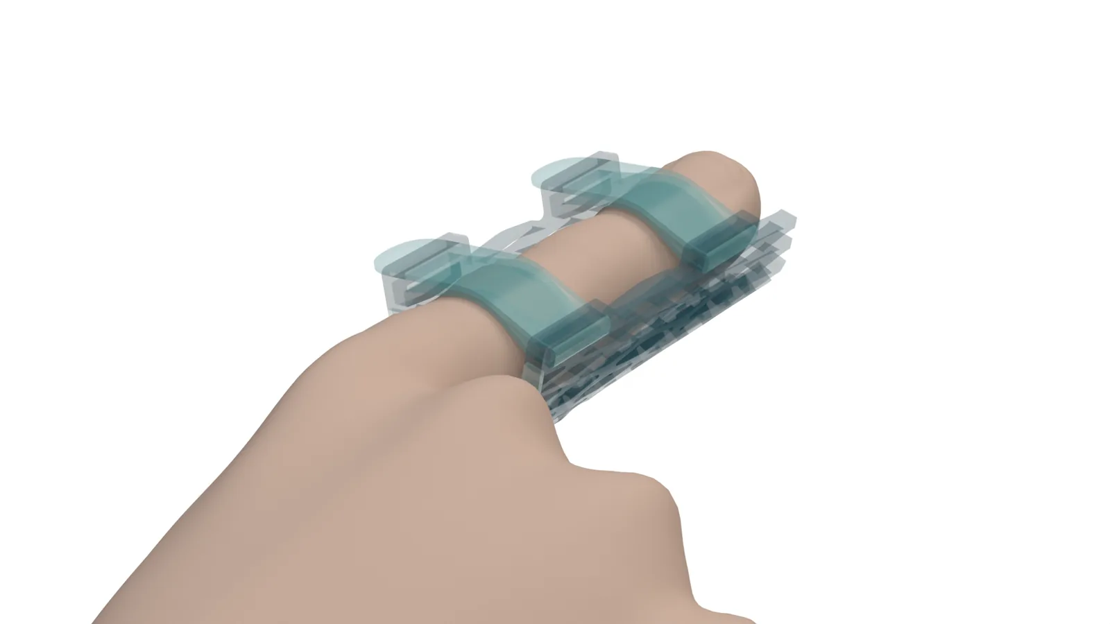 Three-quarter x-ray view of a Struxaform part